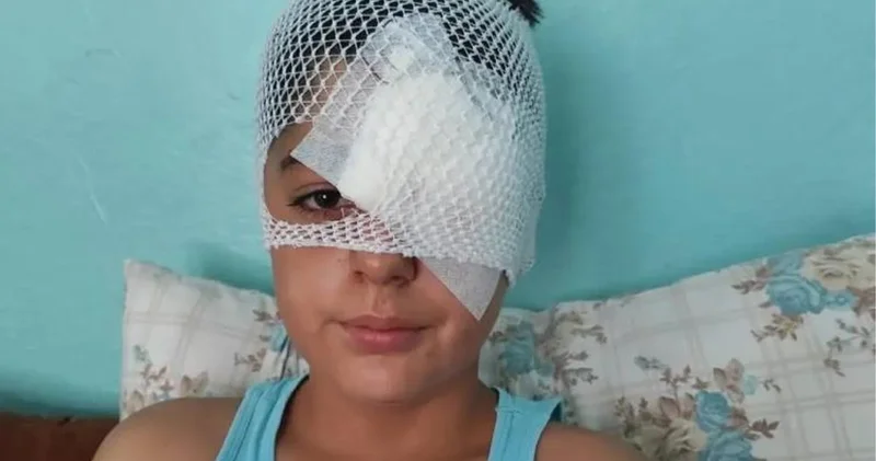 Şanlıurfa da köpek saldırısından kaçarken otomobilin çarptığı çocuk hastaneye kaldırıldı