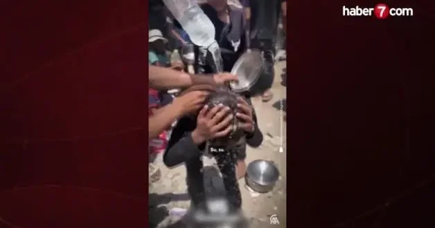Gazze de ailesine yemek götürmek isteyen çocuk üzerine dökülen sıcak çorba nedeniyle yandı!