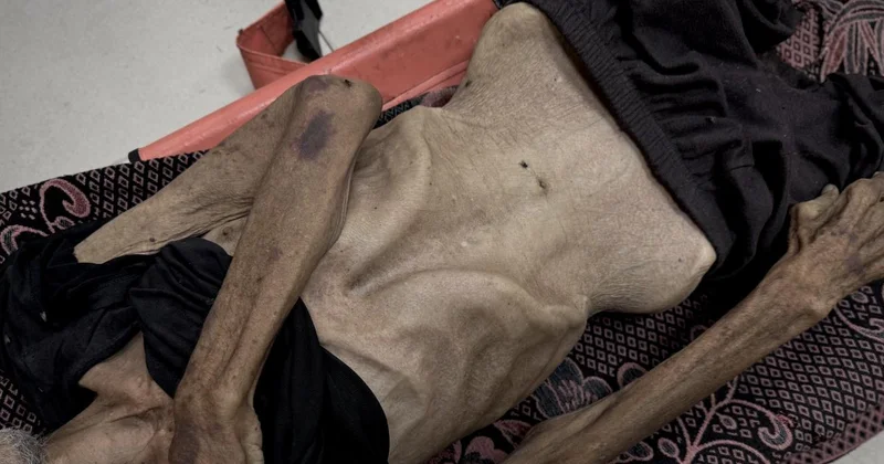 İsrail in kıtlığı dayattığı Gazze de son 24 saatte 5 kişi daha açlıktan hayatını kaybetti