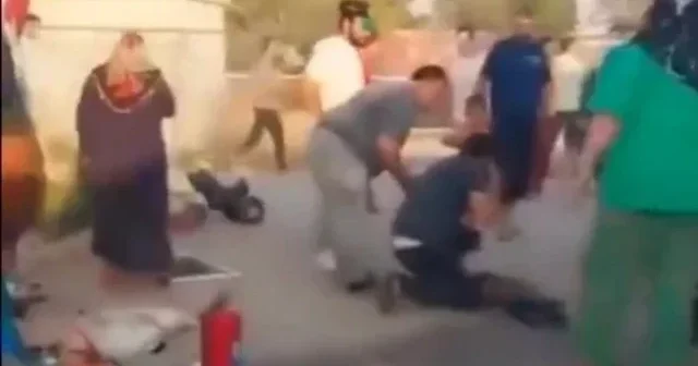 Yangın çıkan konteynerde çocuk bulundu: Ağır yaralı Kahramanmaraş Haberleri