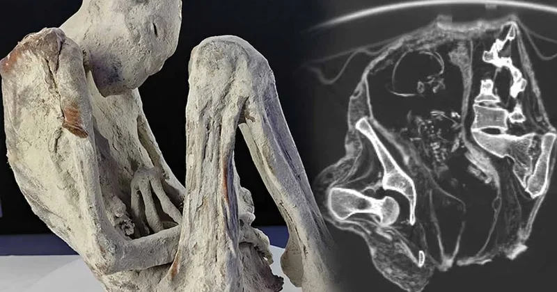 Bilim insanları, 1.200 yıllık mumyalanmış bir bedenin rahminde çarpıcı bir keşifte bulundu Sözcü Gazetesi