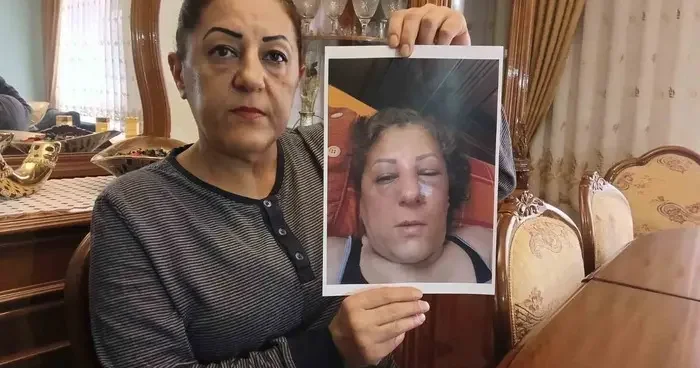 Apartman bahçesinde beslediği kediler nedeniyle komşuları tarafından darbedilen kadının burnu kırıldı