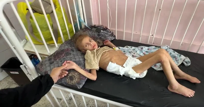 Gazze’de yetersiz beslenme sonucu 12 kiloya düşen 7 yaşındaki May yürüme yetisini kaybetti