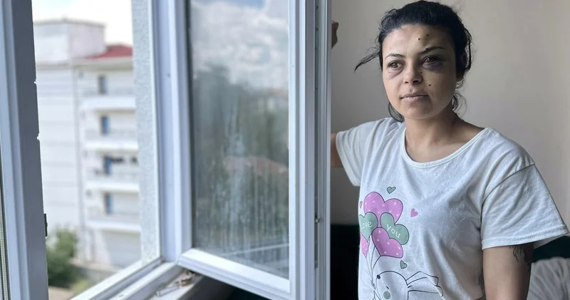 Sokak düğününde maganda ateşi! Saçmalar gözüne isabet etti! Son dakika haberleri