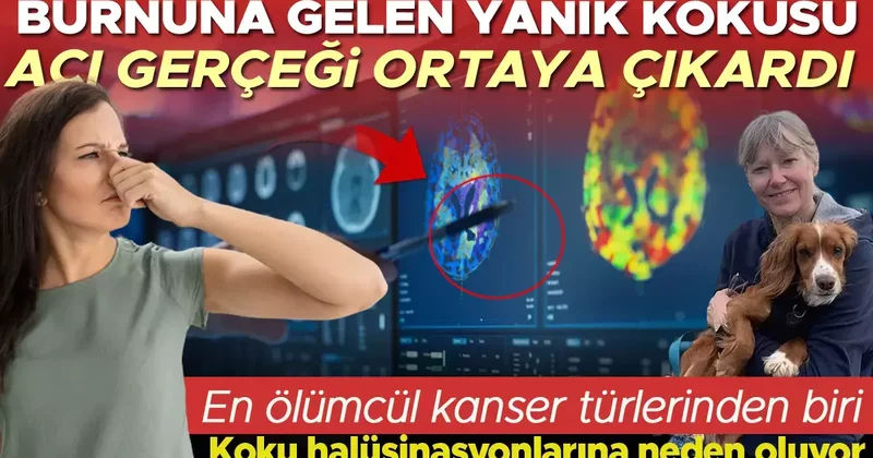 Bir gün burnuna yanık kokusu geldi ve hayatı altüst oldu Meğer hayali kokular o ölümcül hastalığın belirtisiymiş