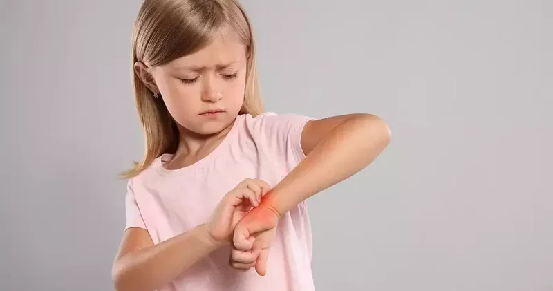 ‘Molluscum enfeksiyonu, yaz aylarında daha kolay bulaşıyor’