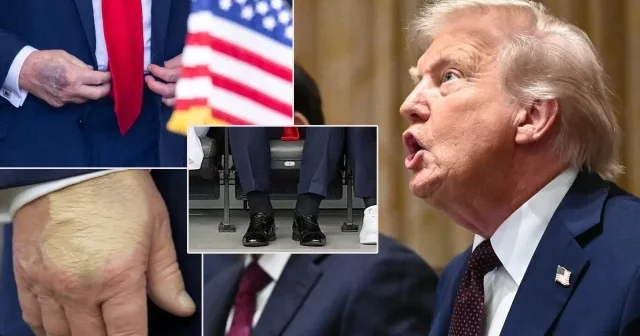 Trump öldü mü? ABD Başkanı 5 gündür kayıp: Vücudundaki değişiklikler dikkat çekmişti Amerika Haberleri