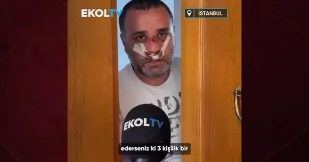 Marmaray’da yumruk yiyen baba konuştu! Olayın perde arkasını anlattı