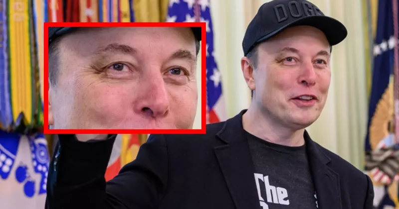 Sağ gözü neden mor? Elon Musk sebebini açıkladı