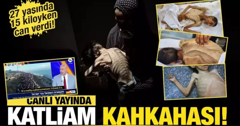 Katliam kahkahası! İsrail Gazze de kıtlığı dayatıyor! 27 yaşında 15 kiloyken can verdi!