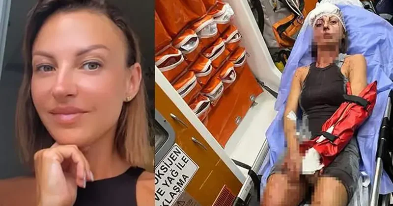 Kocası dehşeti yaşattı! Elleri kırıldı, kafasına zımba atıldı...