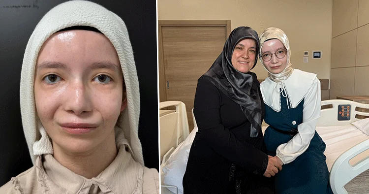 Bu rahatsızlığın adı Moebius sendromu... Doğuştan kullanamıyordu 23 yıl sonra kavuştu: “Sürekli aynaya bakar oldum”