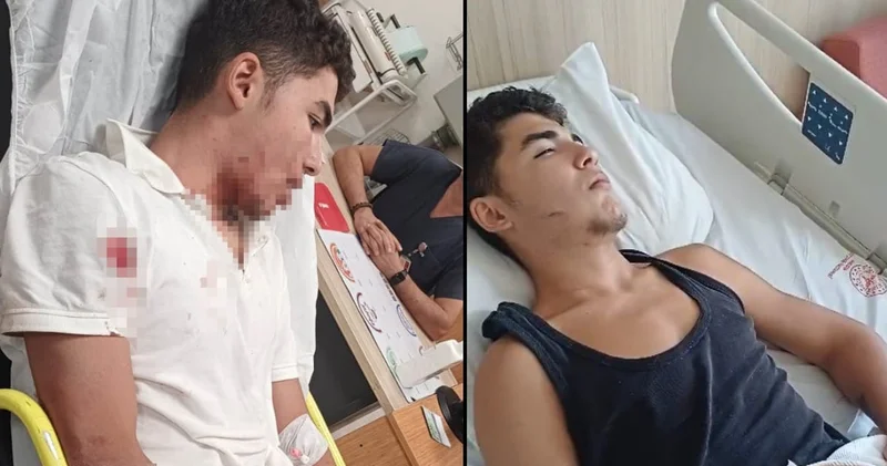 Ankara’da 14 yaşındaki çocuğa vahşi saldırı: Hayati tehlikesi var